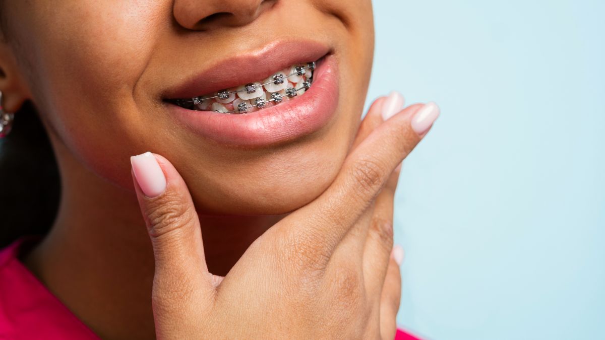 What Causes a Gummy Smile and Can It Be Fixed?